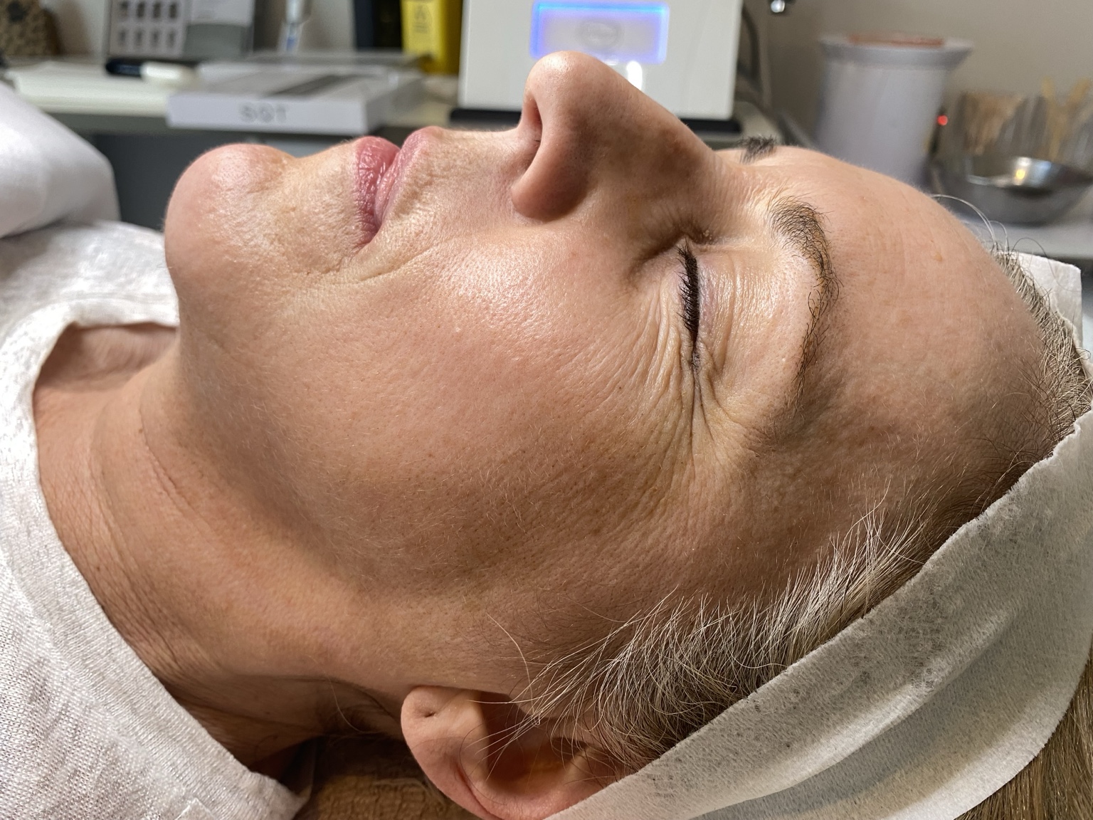 Client receiving an advanced skin treatment at Vershashi Beauty Lounge